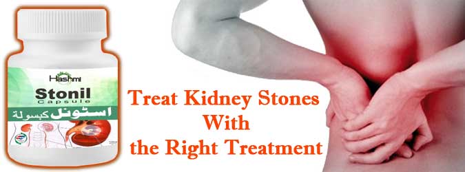 Natural Kidney Stone Treatment